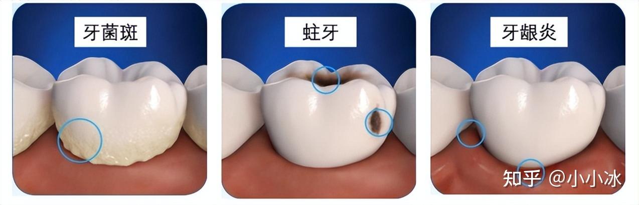 电动牙刷推荐_电动自行车行业现状_电动牙刷测评