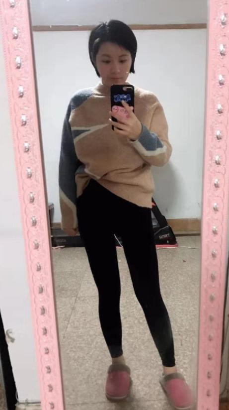 手臂粗做抽脂会反弹吗_腿部吸脂术后效果_光子嫩肤术后护理