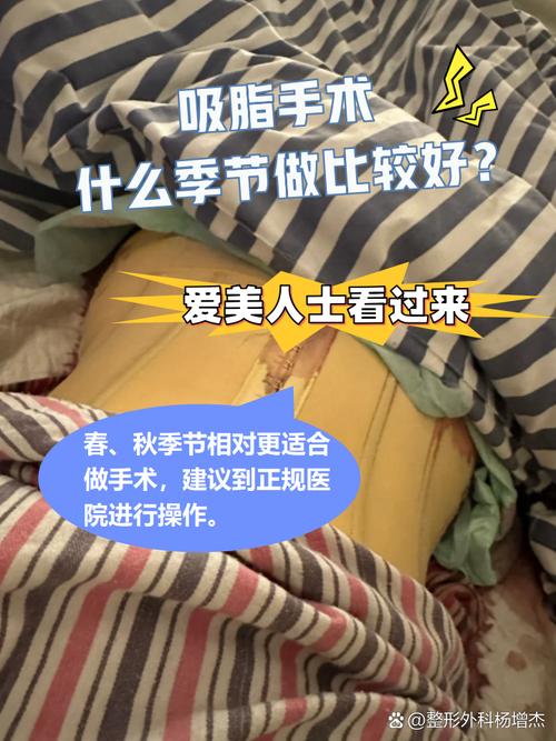 抽脂手术适合人群_手臂粗做抽脂会反弹吗_夏日减肥抽脂手术